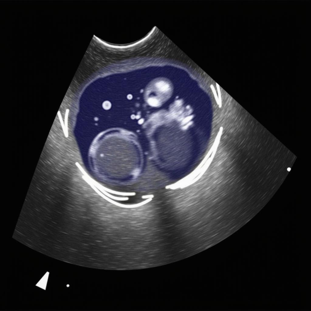 3D Echocardiography at ASE Echo 2019