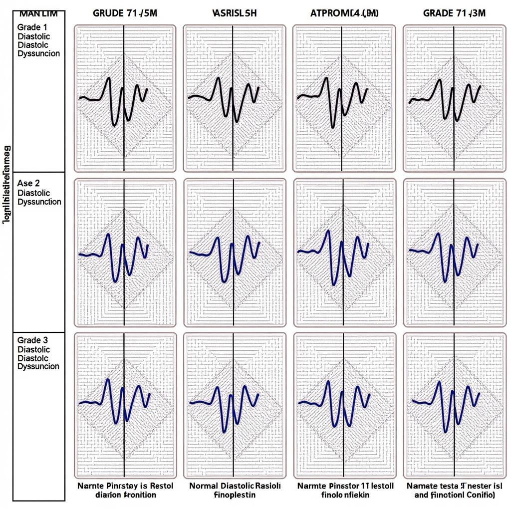 Ase Diastolic Function Chart Patterns