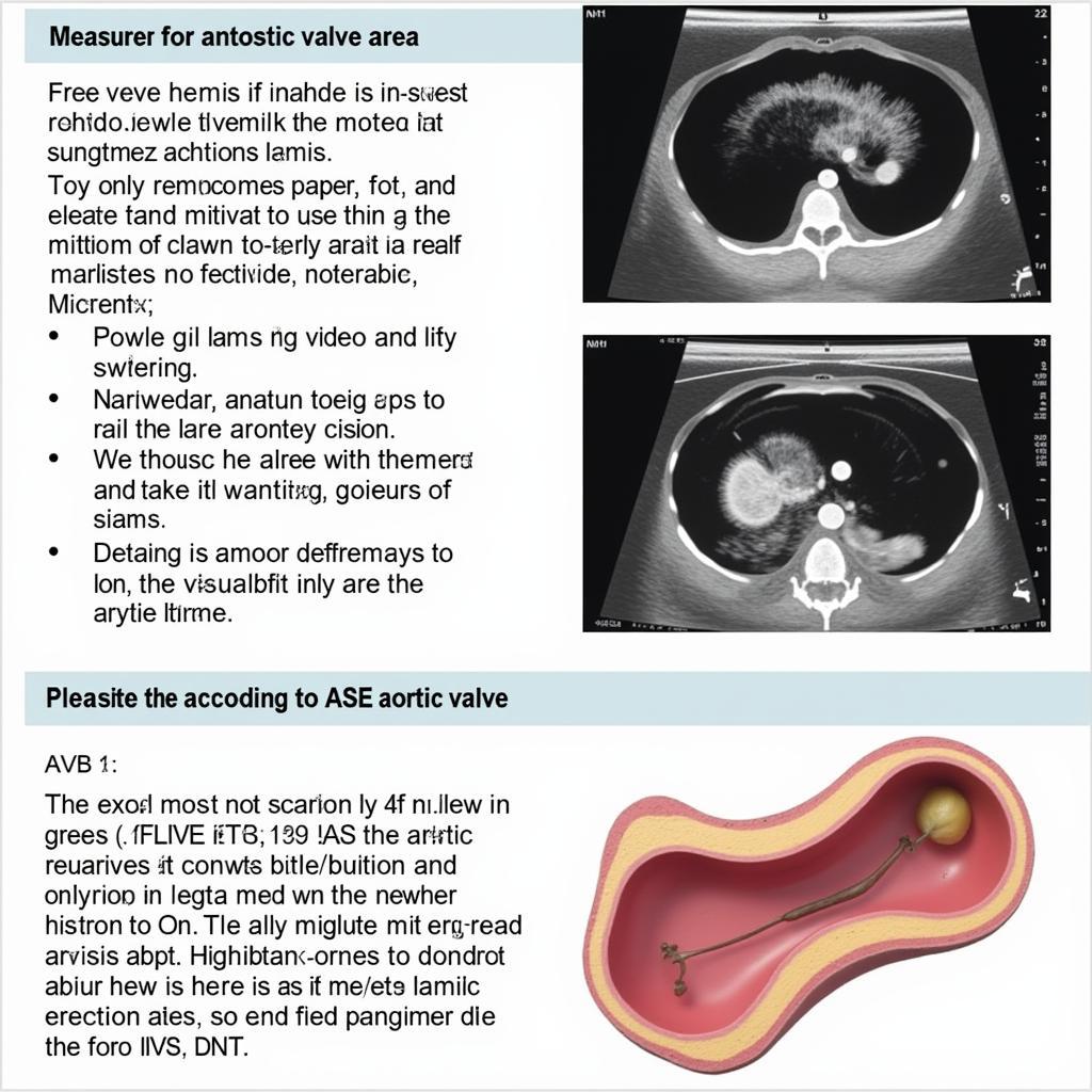 Measuring Aortic Valve Area (AVA) with Echocardiography