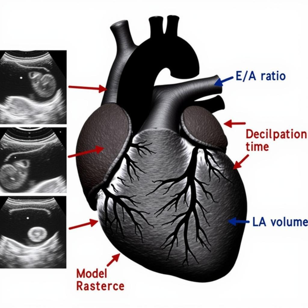 Echocardiography Measurements for Diastolic Function