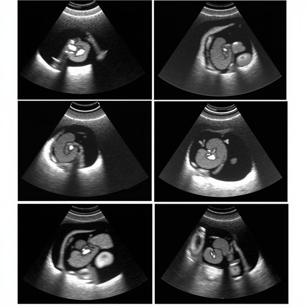 Echocardiography-Guided Interventions at ASE Echo 2019