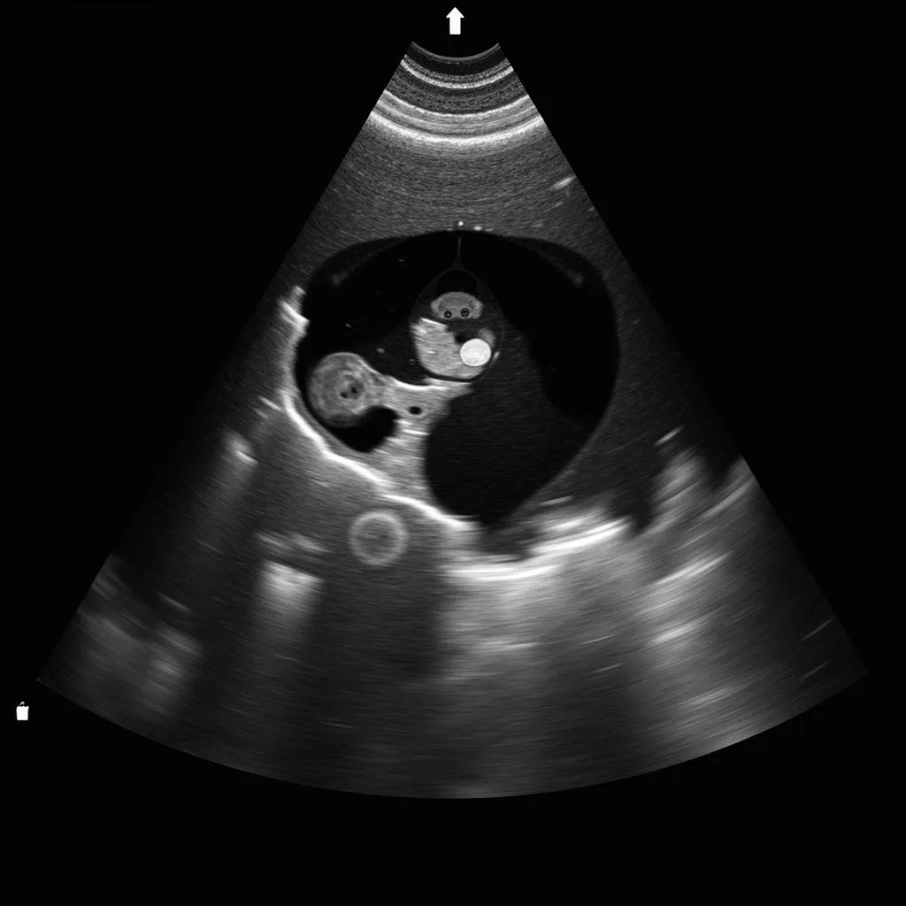 Echocardiography for Valvular Regurgitation Assessment