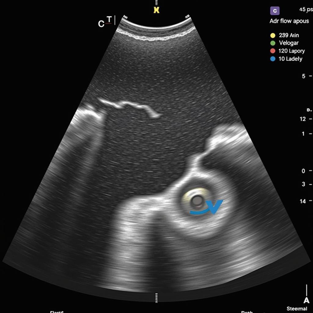 Echocardiography for Aortic Stenosis Diagnosis