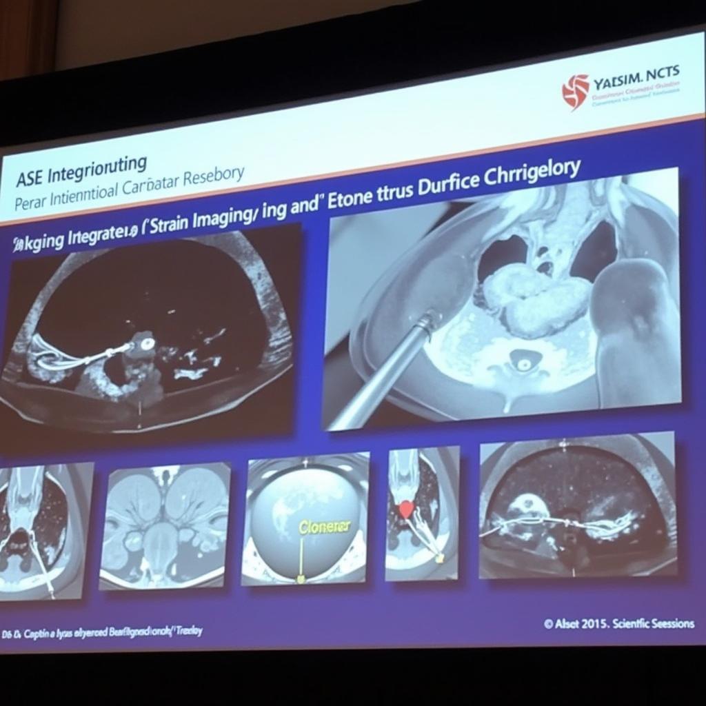 Strain Imaging and Interventional Procedures at ASE 2015