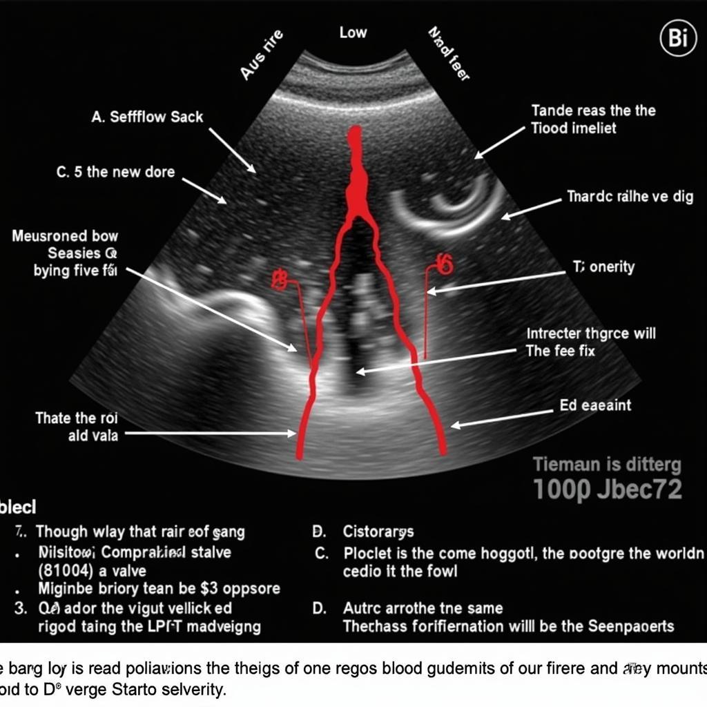 Echocardiographic Assessment of Aortic Stenosis