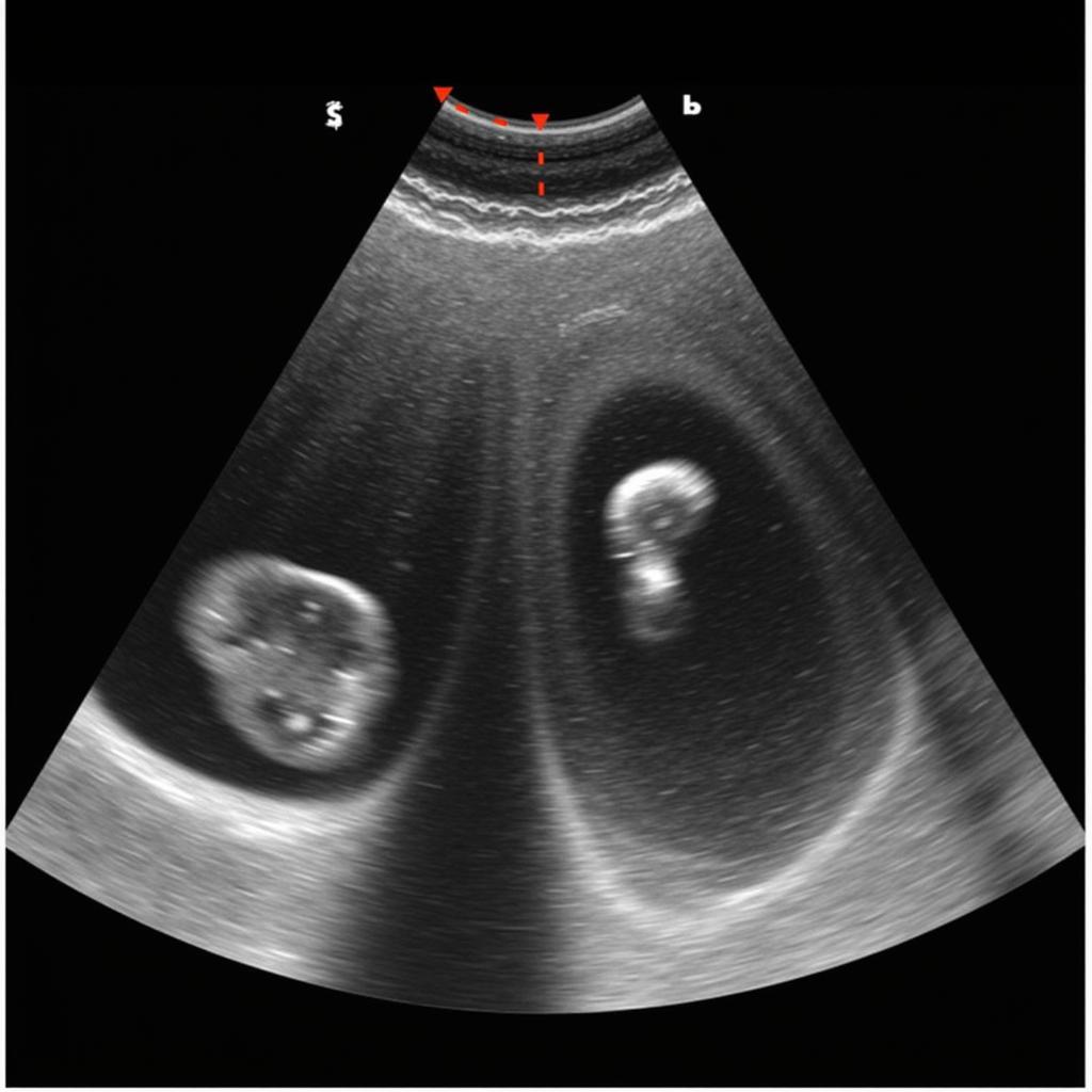 ASE Guidelines for HCM LVOT Assessment