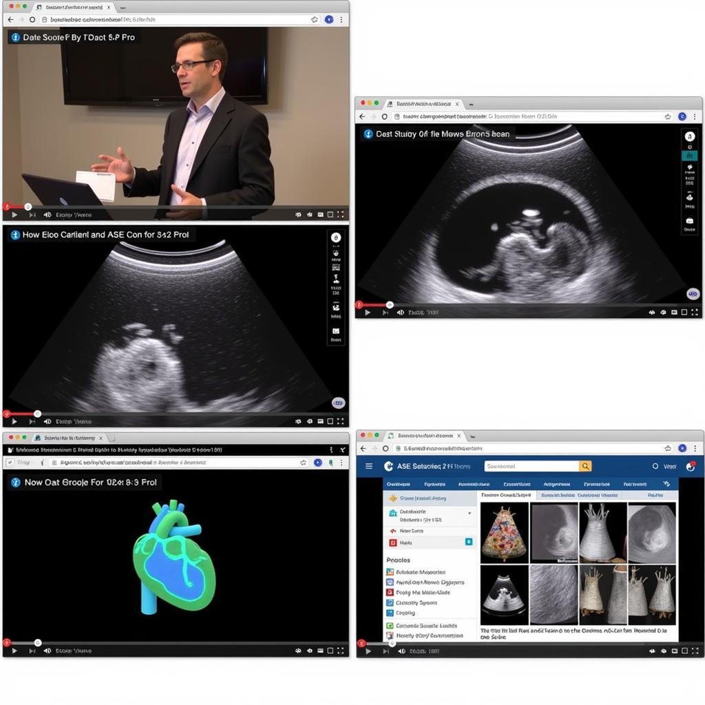 Different Types of ASE Echo Board Videos