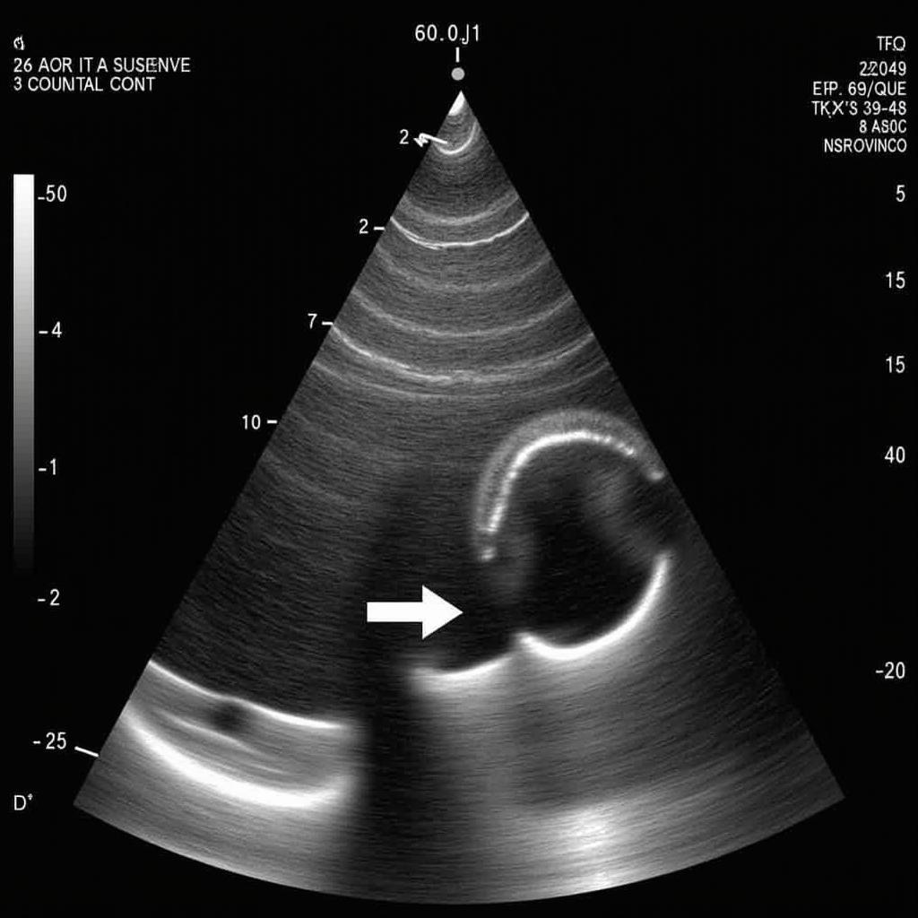 Echocardiography for Aortic Regurgitation Diagnosis