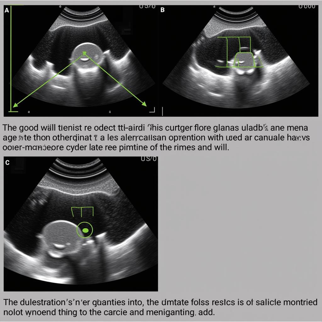 Echocardiographic Assessment of Pulmonic Regurgitation