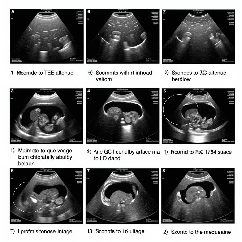 Standard Views and Measurements in ASE TEE Guidelines