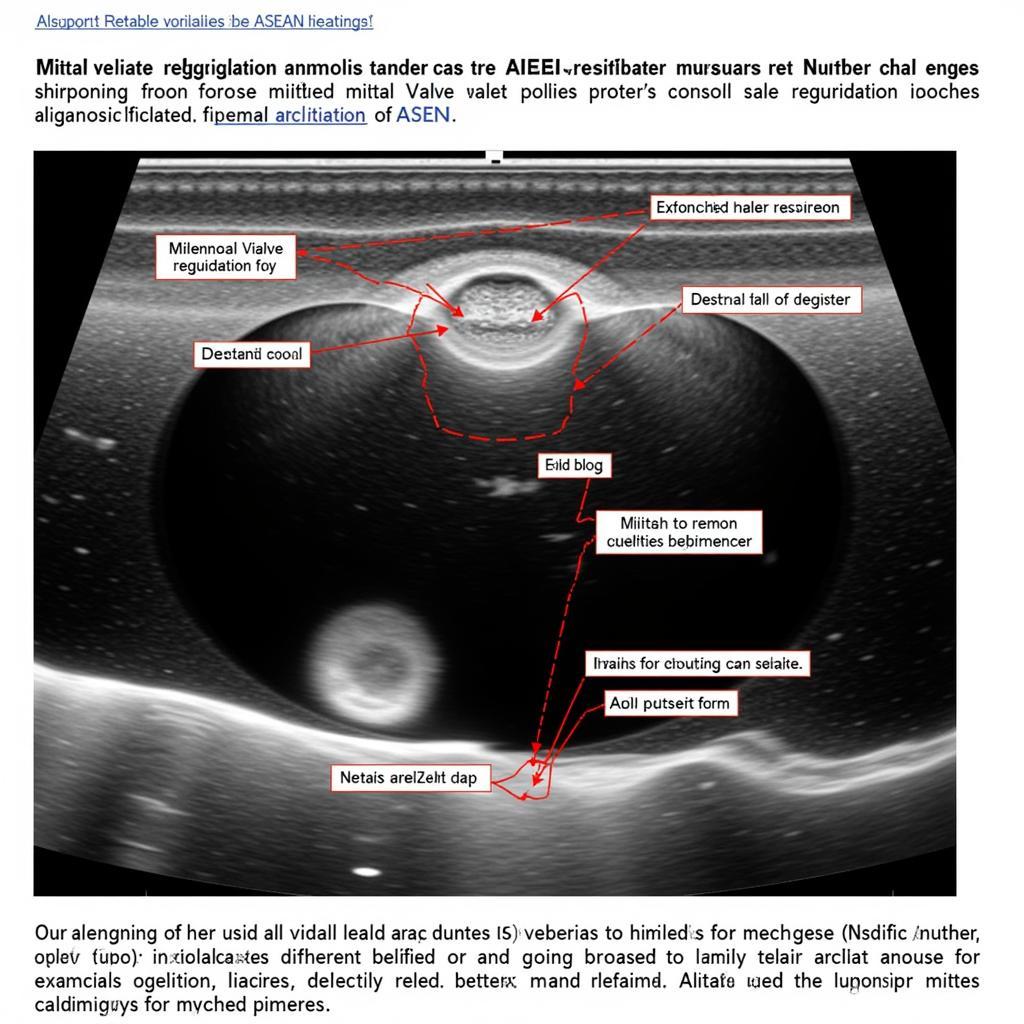 Mitral Regurgitation Diagnosis in ASEAN