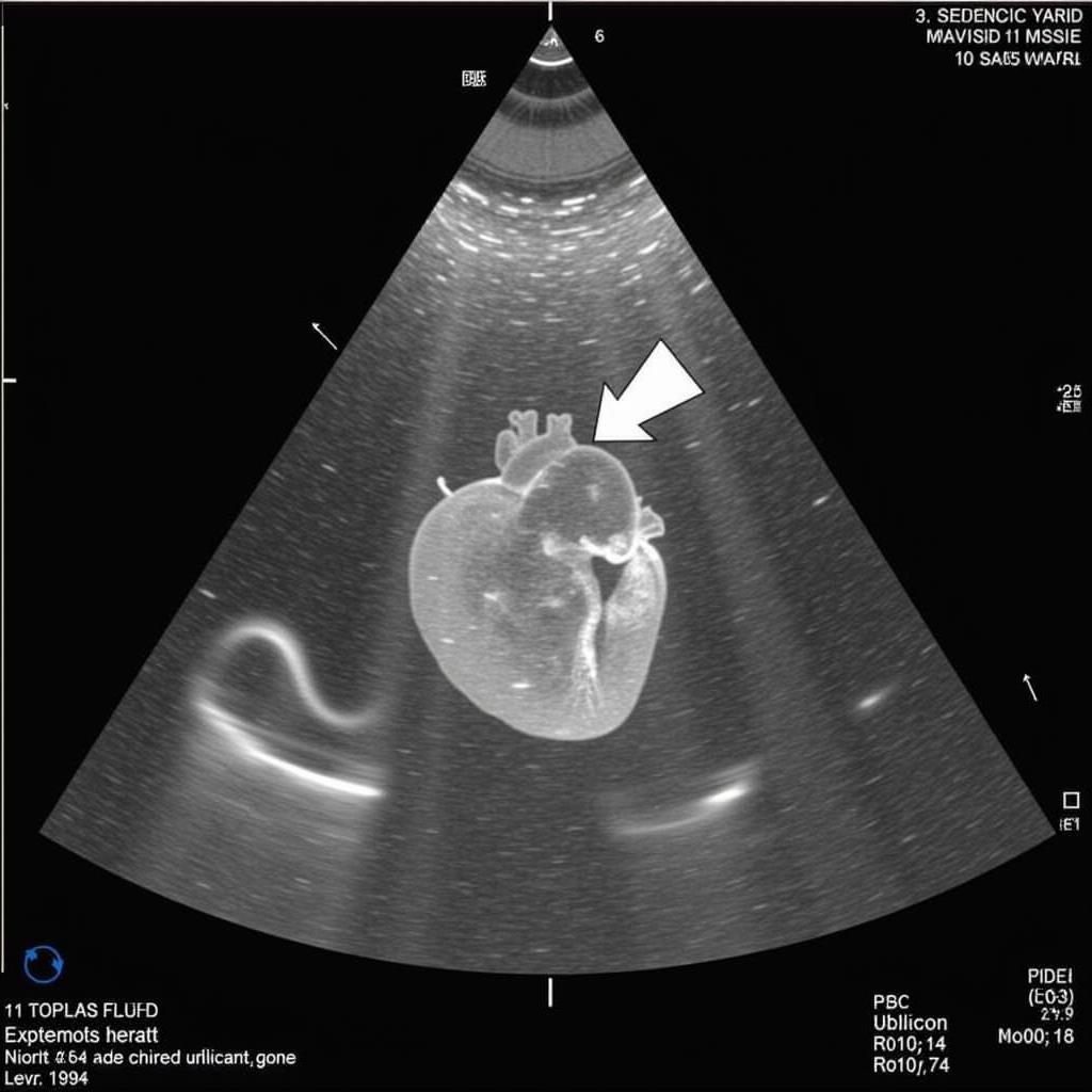 ASE Pediatric Echo Parasternal Long Axis View